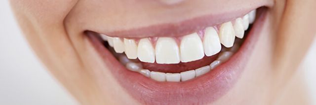 Comment éviter d’avoir besoin d’une greffe de gencive : 5 secrets de dentiste