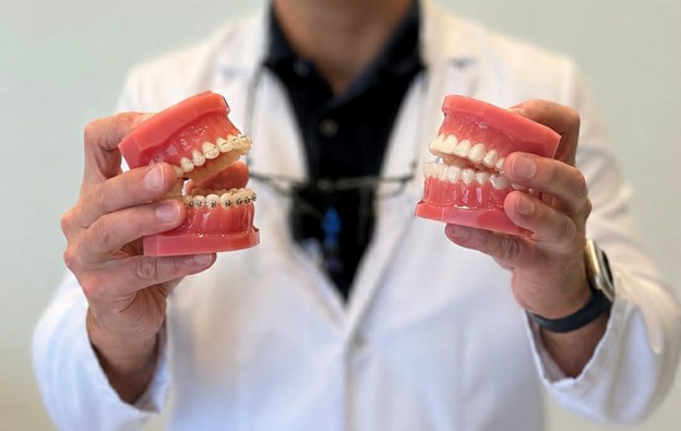 Broches ou Invisalign : quels sont les avantages de chacun ?