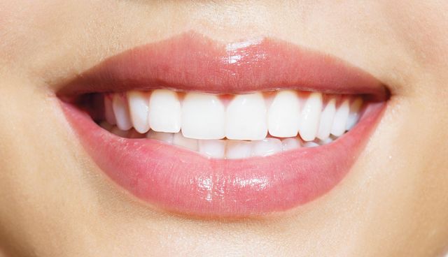 Maintenir ses dents blanches après un blanchiment