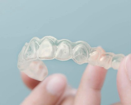 Grand ménage de printemps : édition gouttières Invisalign